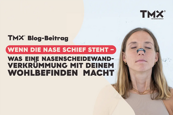 Wenn die Nase schief steht – was eine Nasenscheidewandverkrümmung mit deinem Wohlbefinden macht